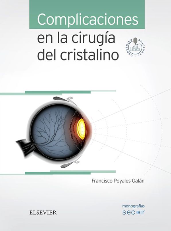 Complicaciones en la cirugía del cristalino: Monografías SECOIR