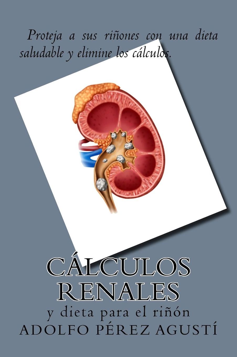 Calculos Renales: Y Dieta Para El Rinon