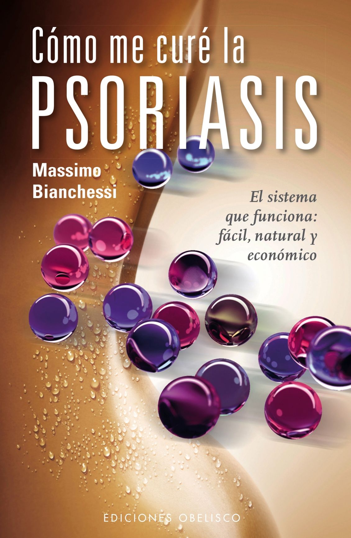 Psoriasis