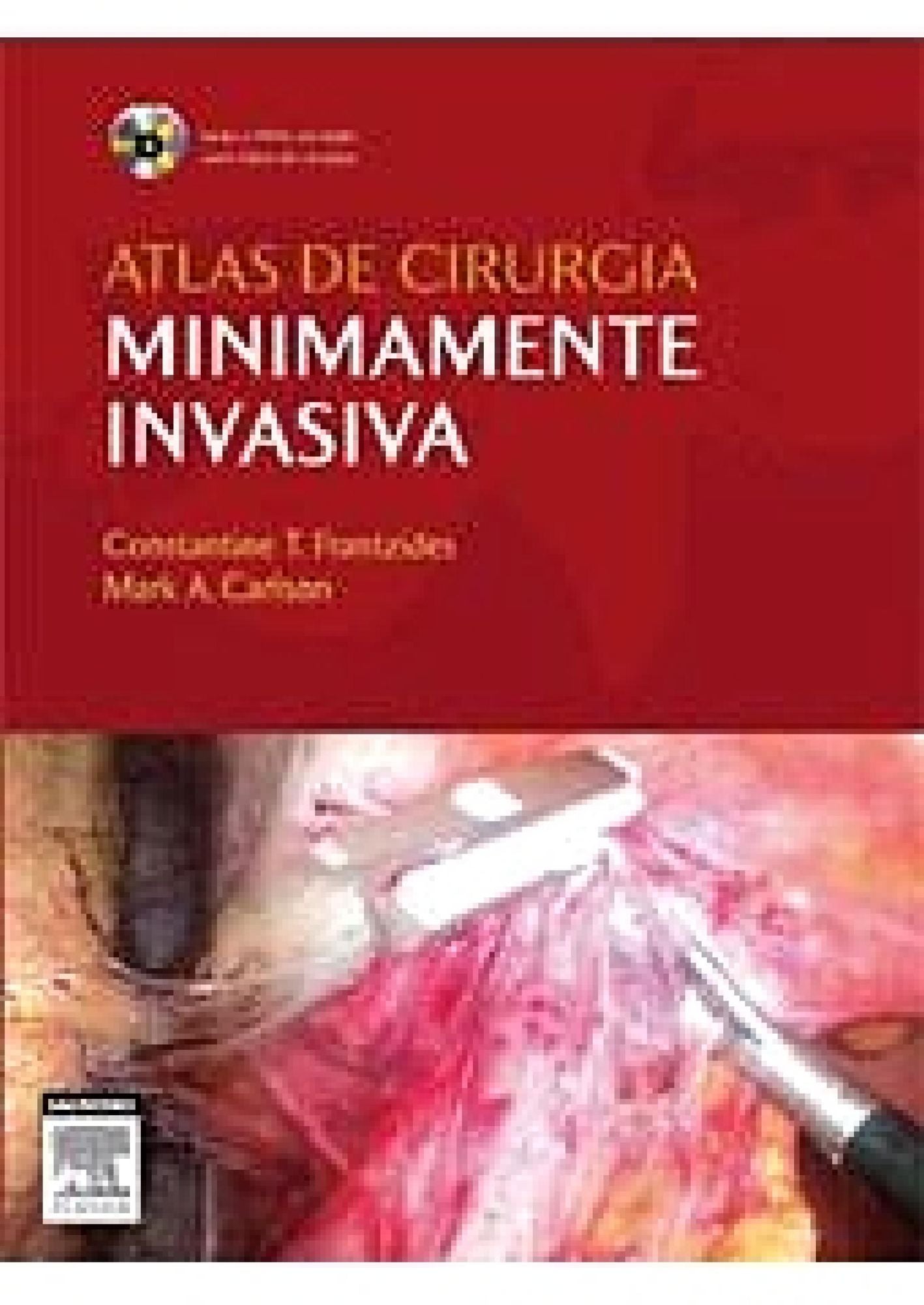 Atlas De Cirurgia Minimamente Invasiva