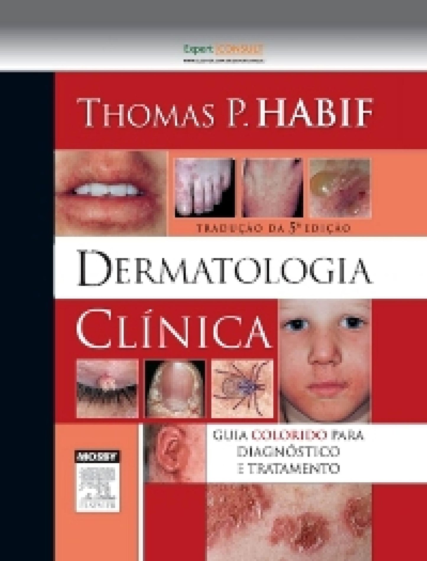 Dermatologia Clínica: Guia Colorido para Diagnóstico e Tratamento