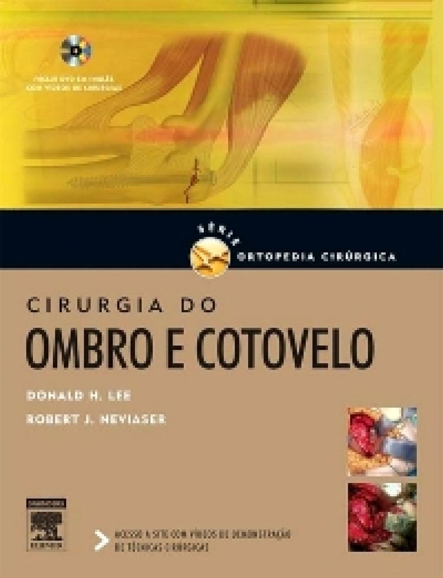 Cirurgia Do Ombro E Cotovelo Série De Ortopedia Cirúrgica
