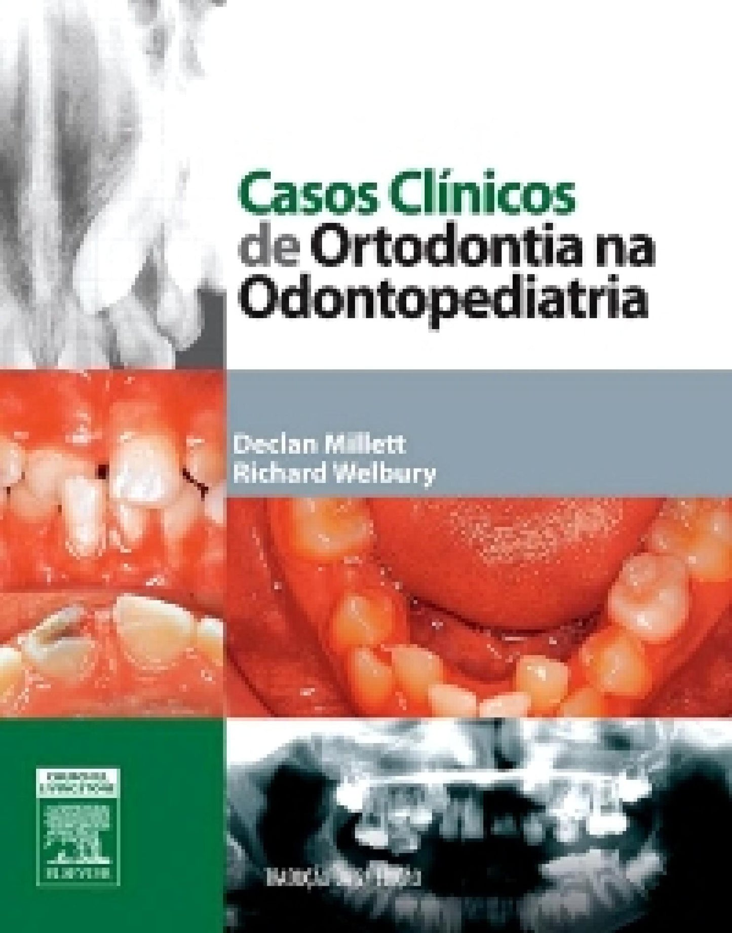 Casos Clínicos de Ortodontia na Odontopediatria
