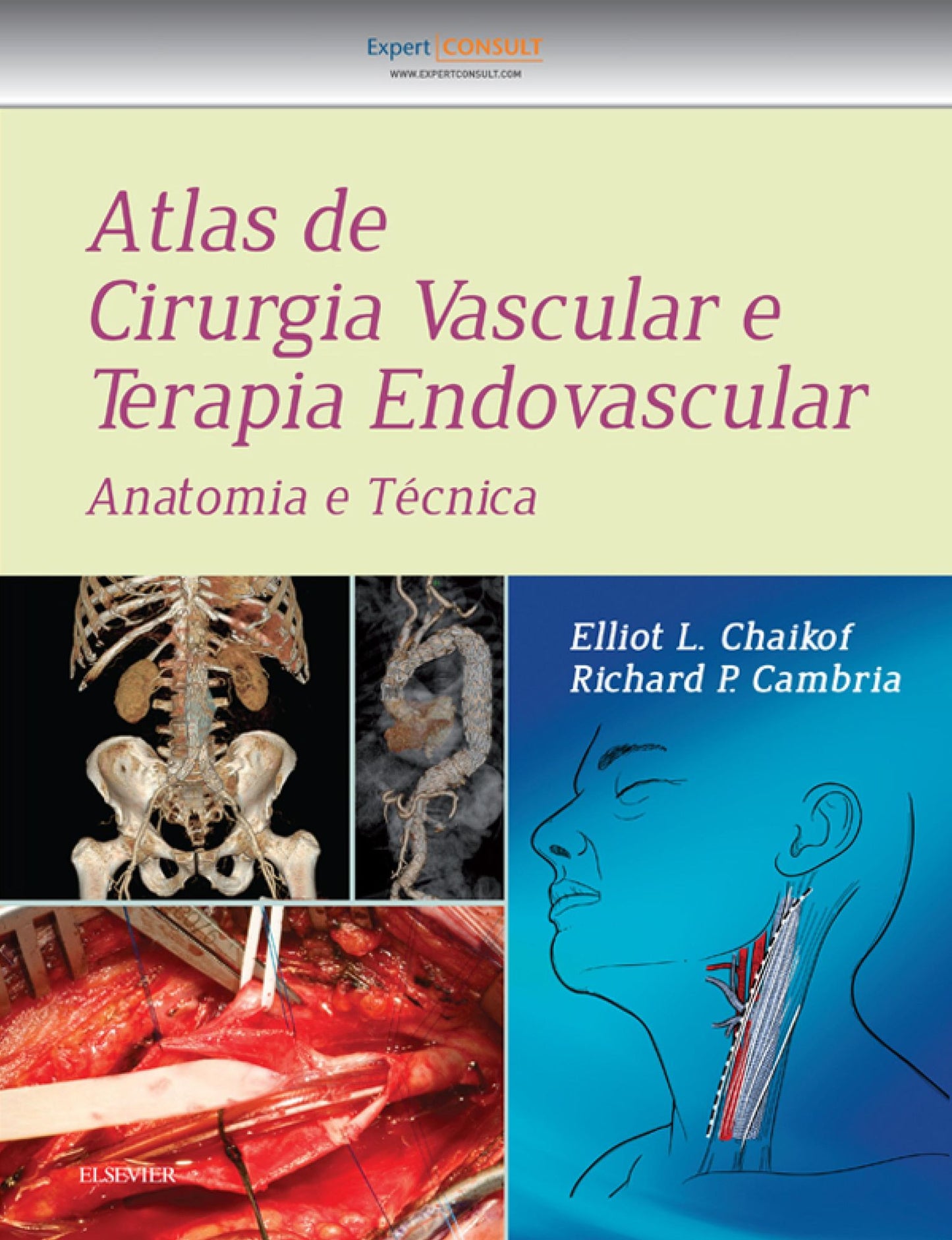 Atlas de Cirurgia Vascular e Terapia Endovascular: Anatomia e Técnica