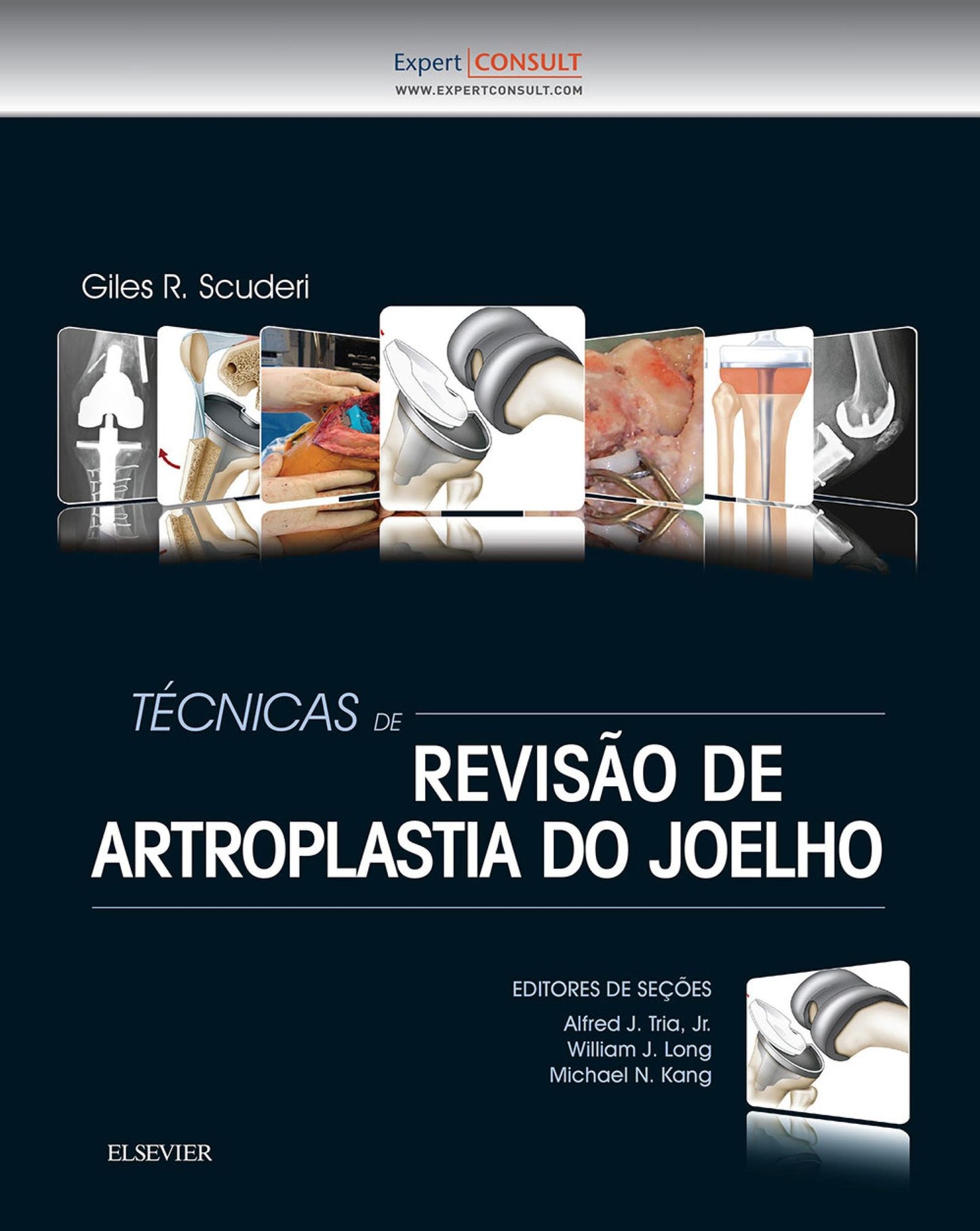 Técnicas de Revisão de Artroplastia do Joelho