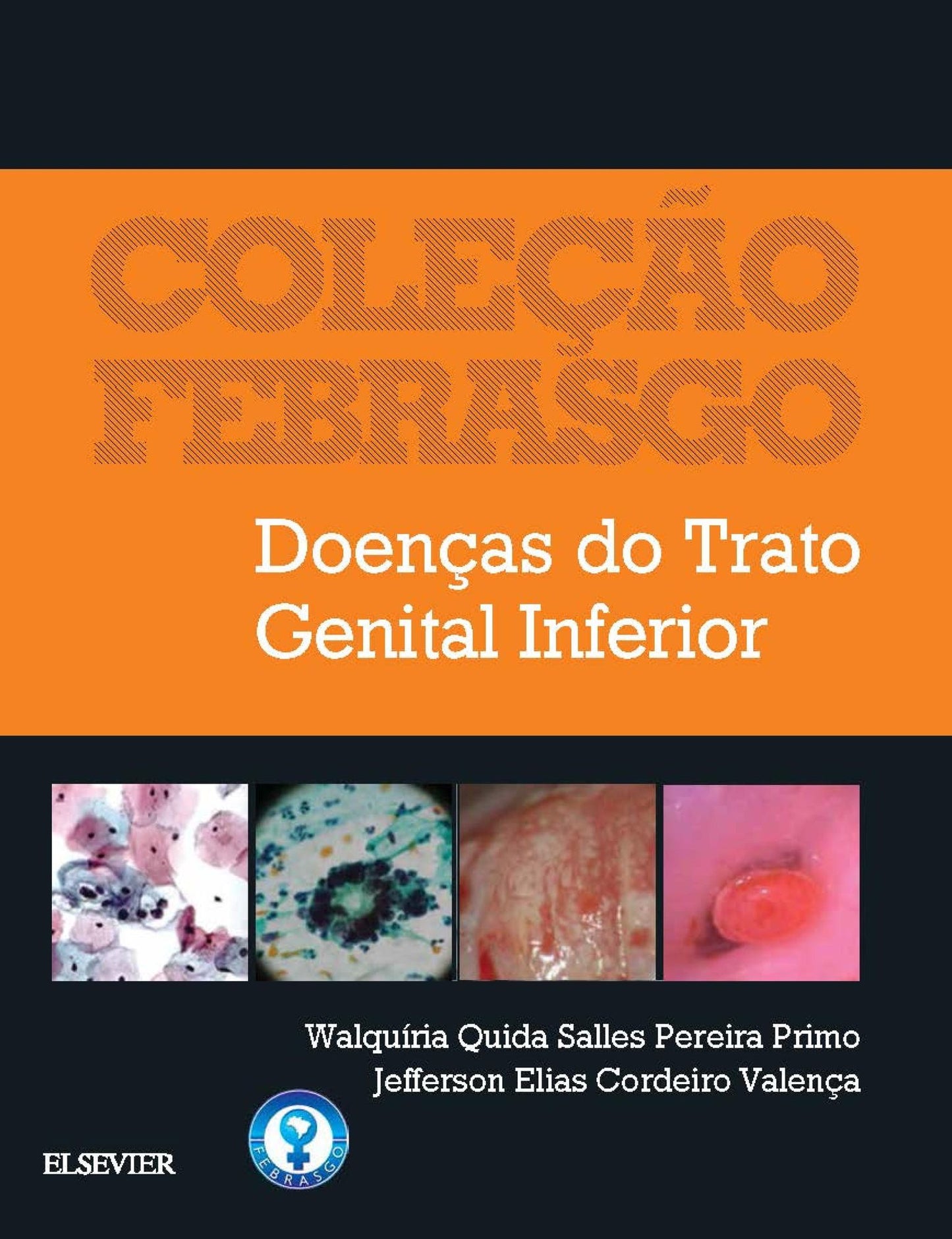 Doenças do Trato Genital Inferior