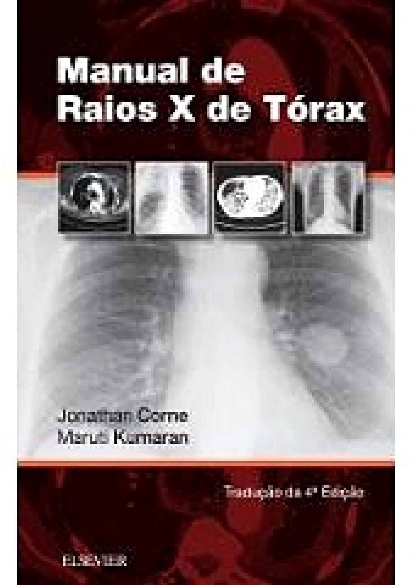 Manual de Raios-X de Tórax
