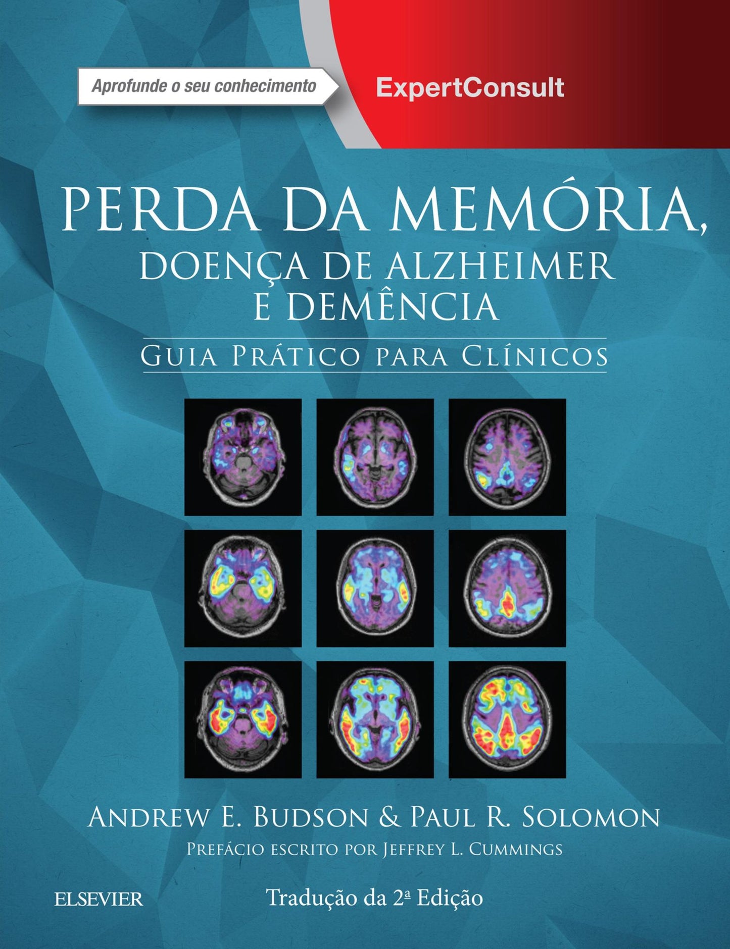 Perda da Memória, Doença de Alzheimer e Demência