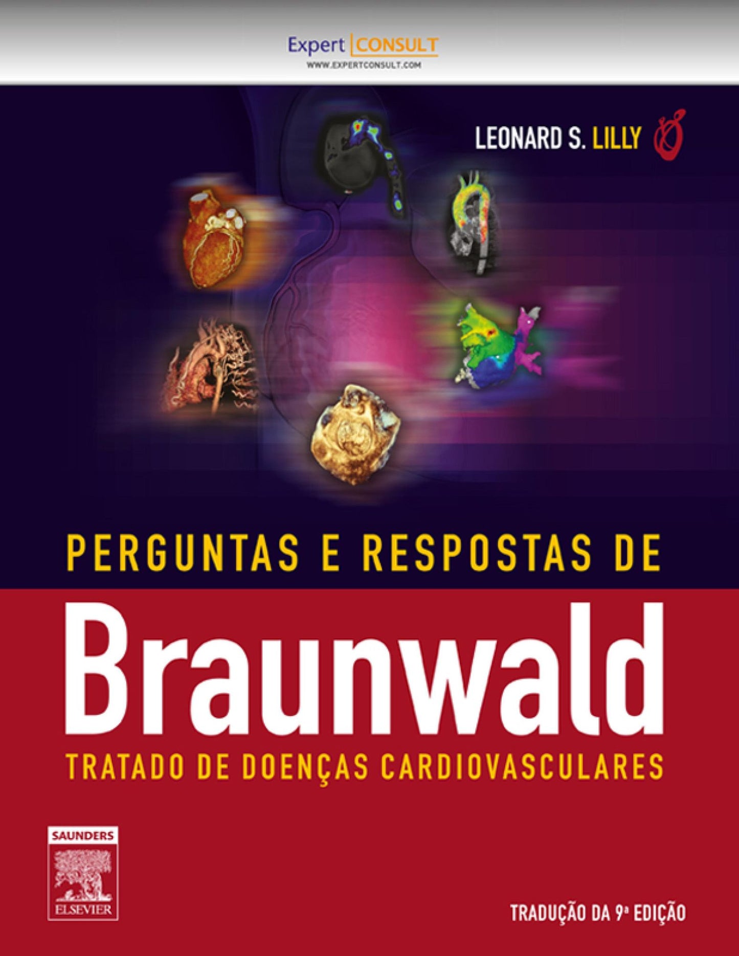 Perguntas e Respostas Braunwald Tratado Doenças Cardiovasculares