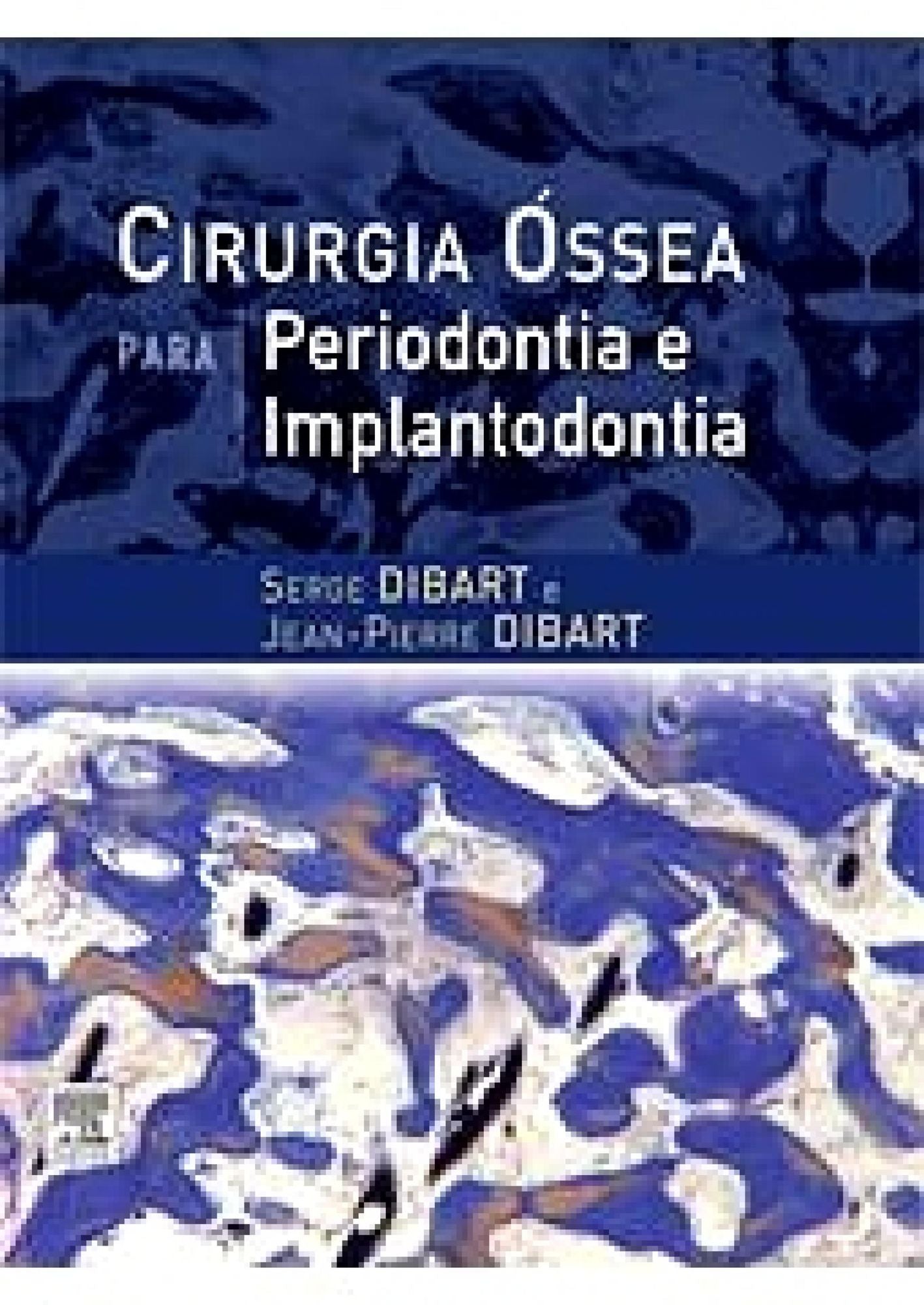 Cirurgia Óssea para Periodontia e Implantodontia