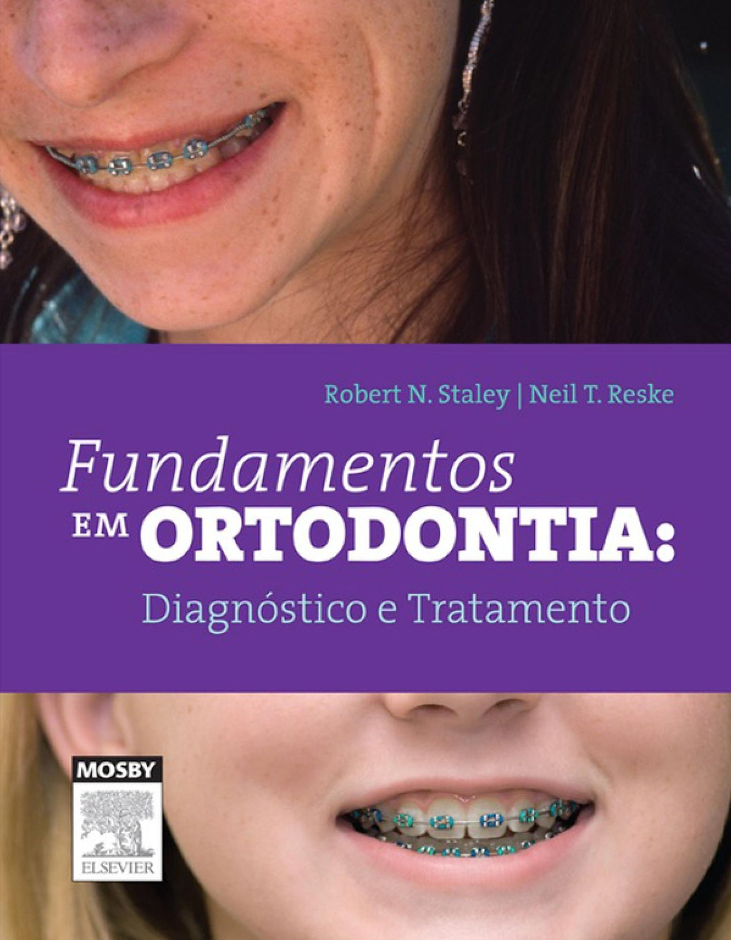Fundamentos em Ortodontia: Diagnóstico e Tratamento