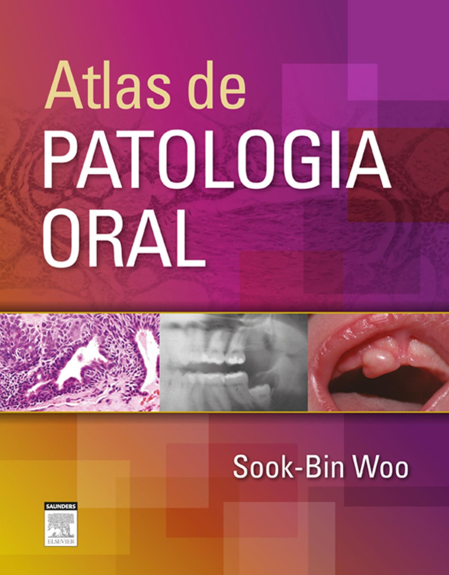 Atlas de Patologia Oral