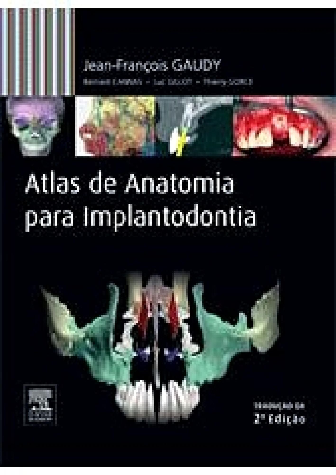 Atlas de Anatomia para Implantodontia