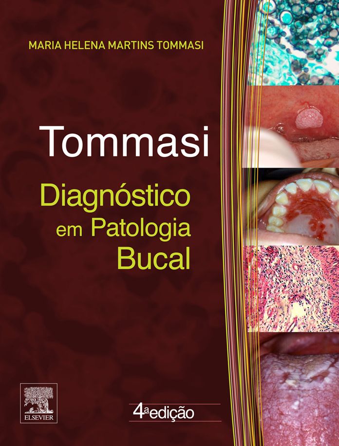 Diagnóstico em Patologia Bucal