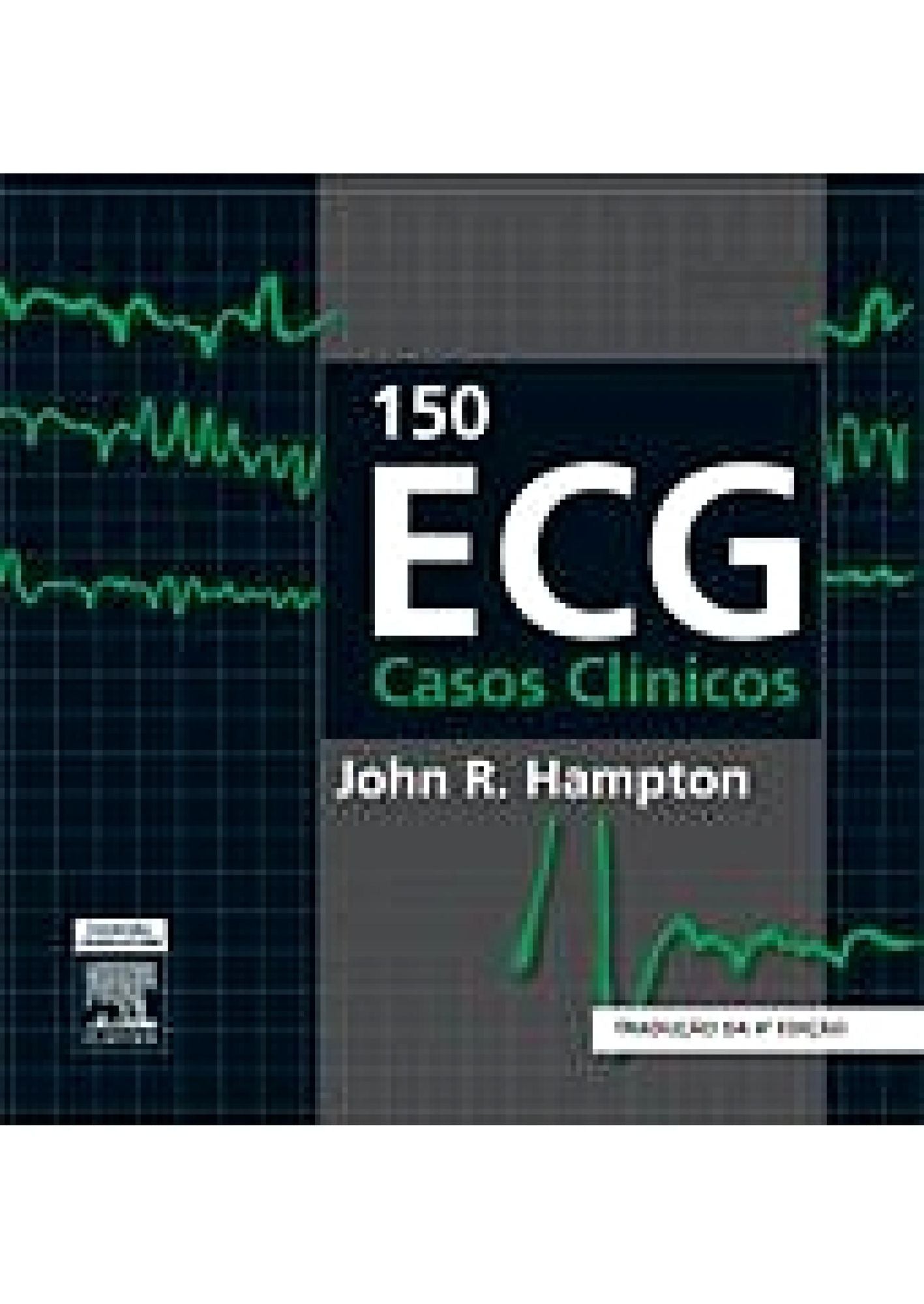 150 ECG Casos Clinicos