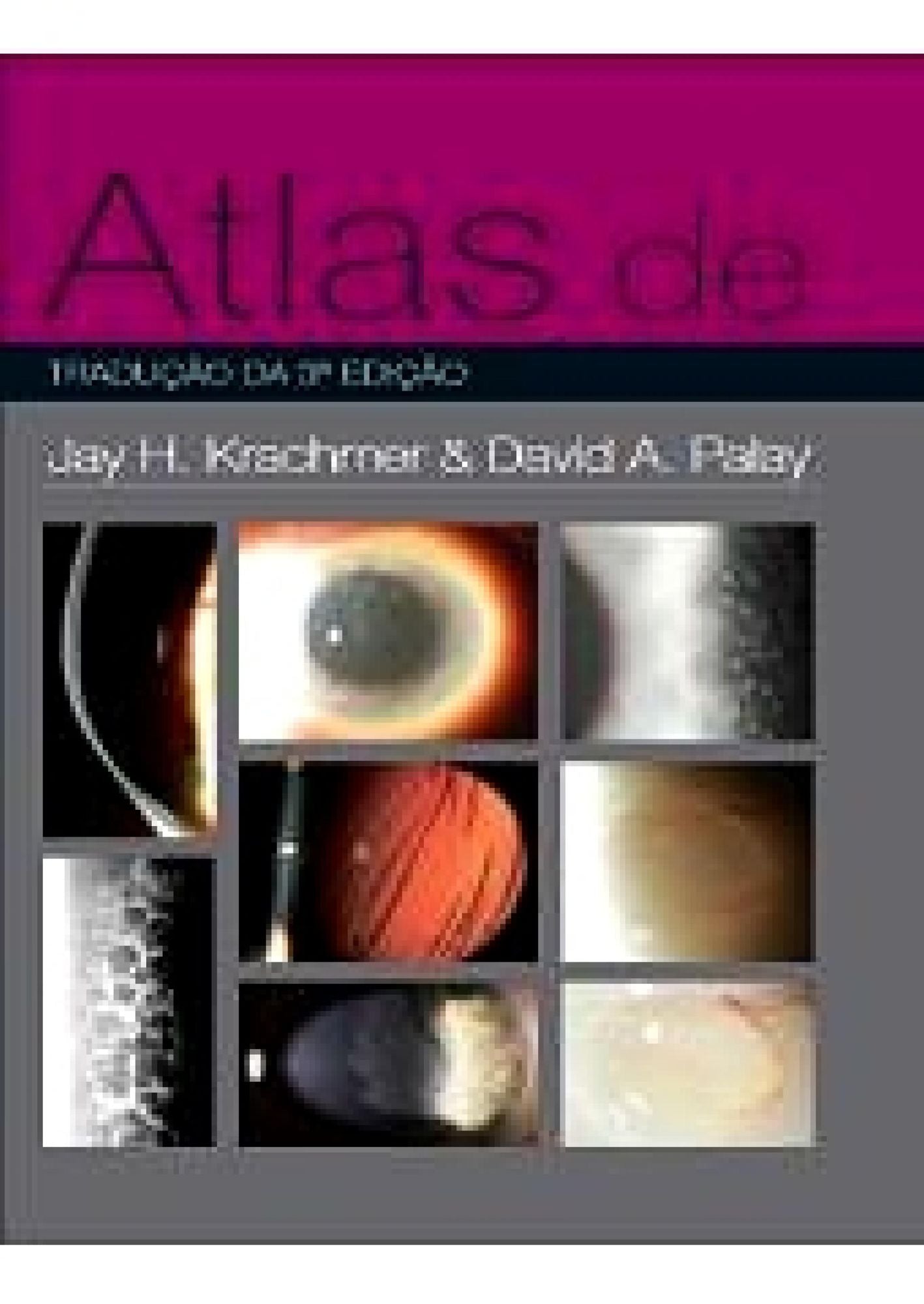 Atlas de Córnea