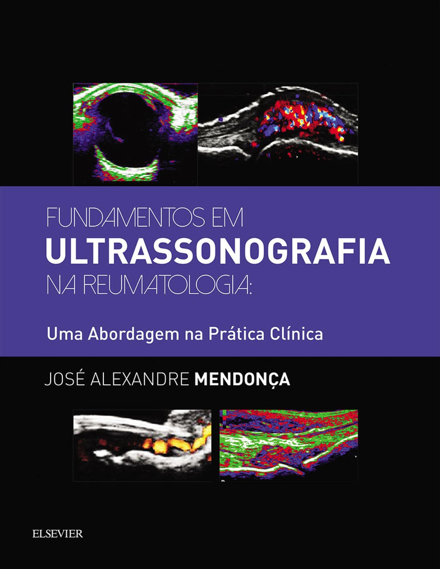Fundamentos em Ultrassonografia na Reumatologia: Uma abordagem na prática clínica