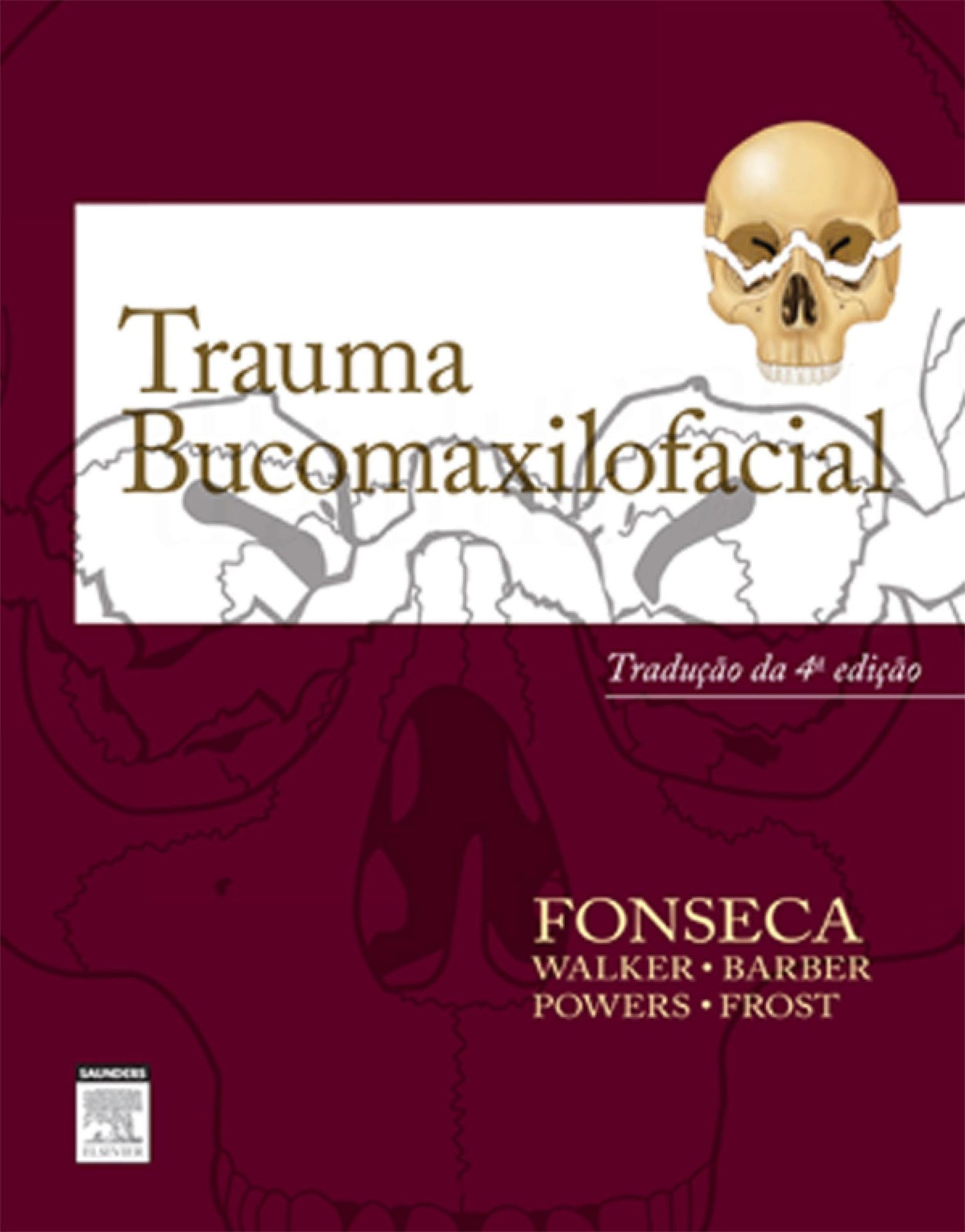 Trauma Bucomaxilofacial