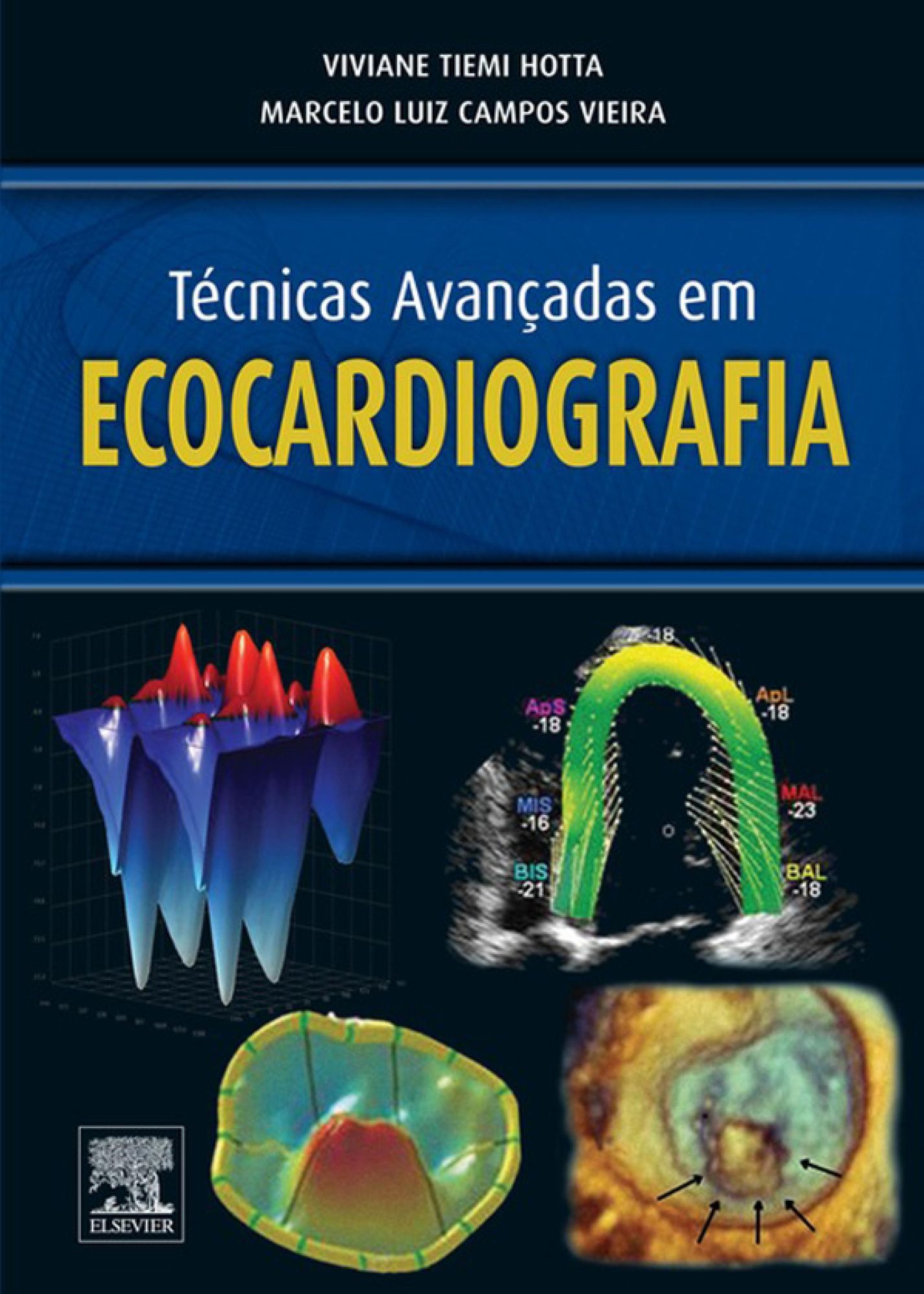 Técnicas Avançadas em Ecocardiografia
