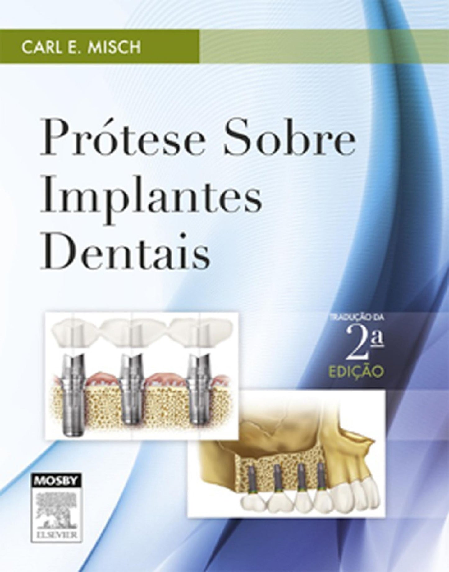 Prótese sobre Implantes Dentais