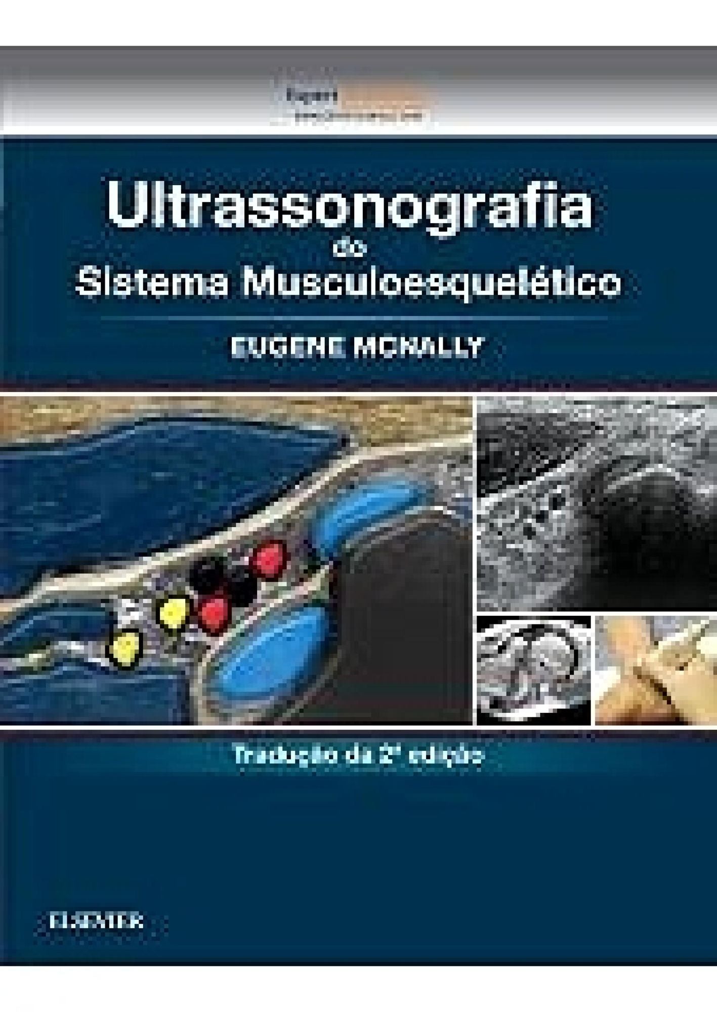 Ultrassonografia do Sistema Musculoesquelético