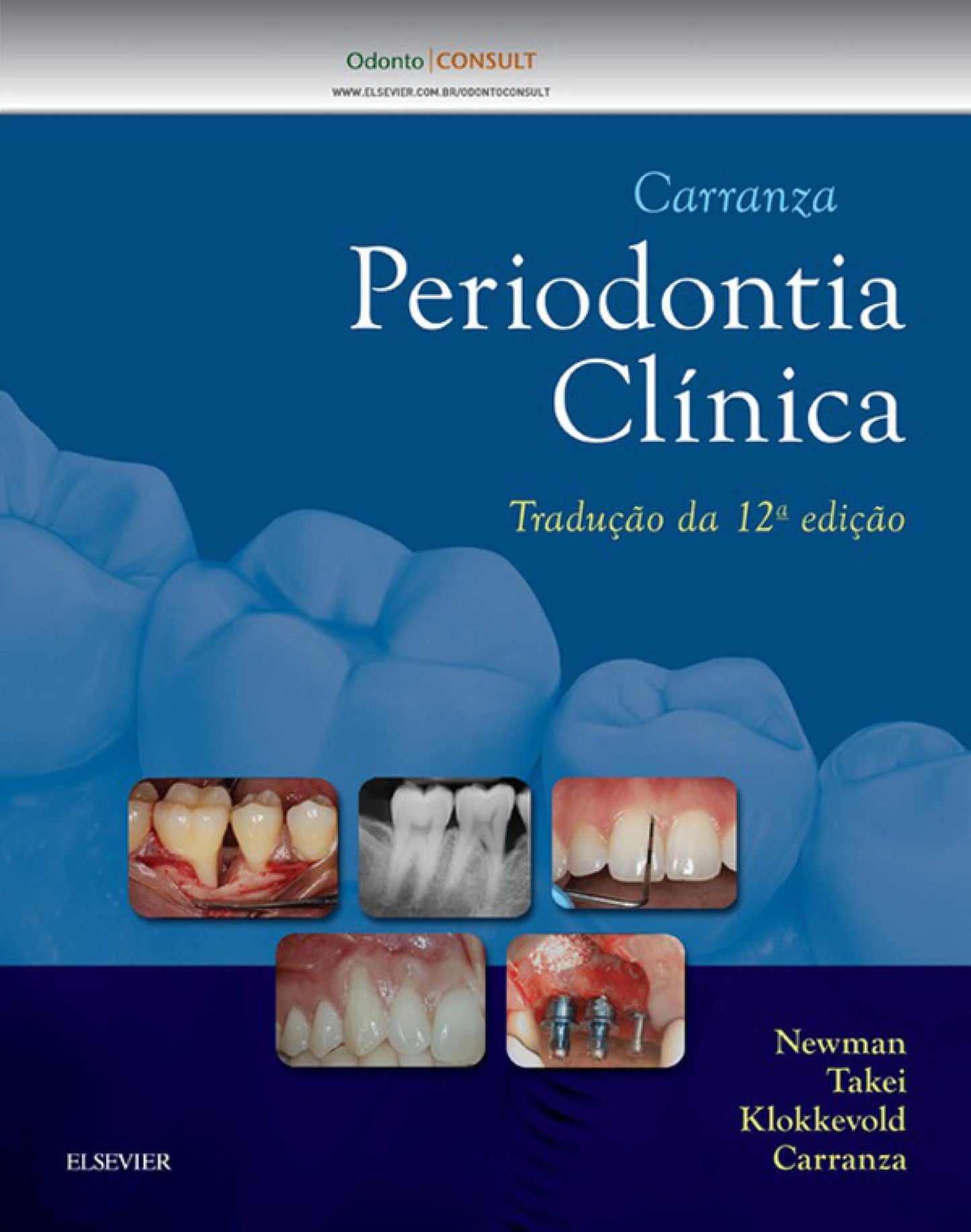 Carranza Periodontia Clínica