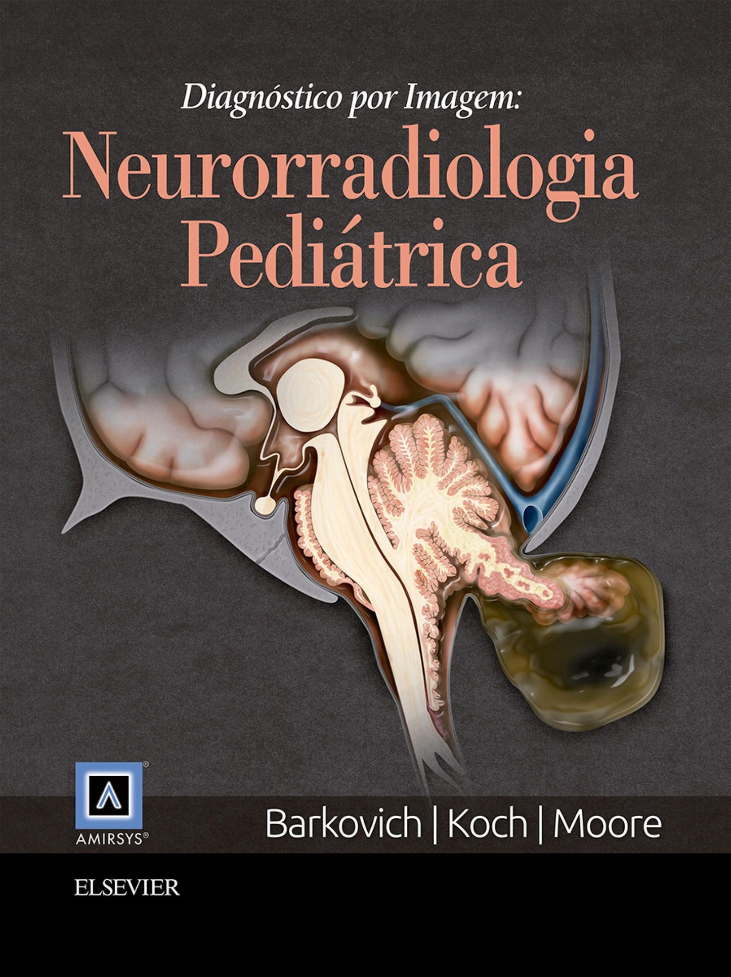 Diagnóstico por Imagem: Neurorradiologia Pediátrica