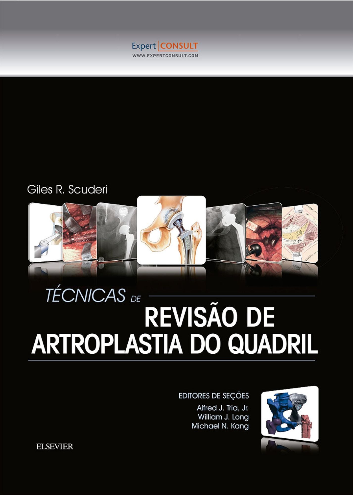Técnicas de Revisão de Artroplastia do Quadril