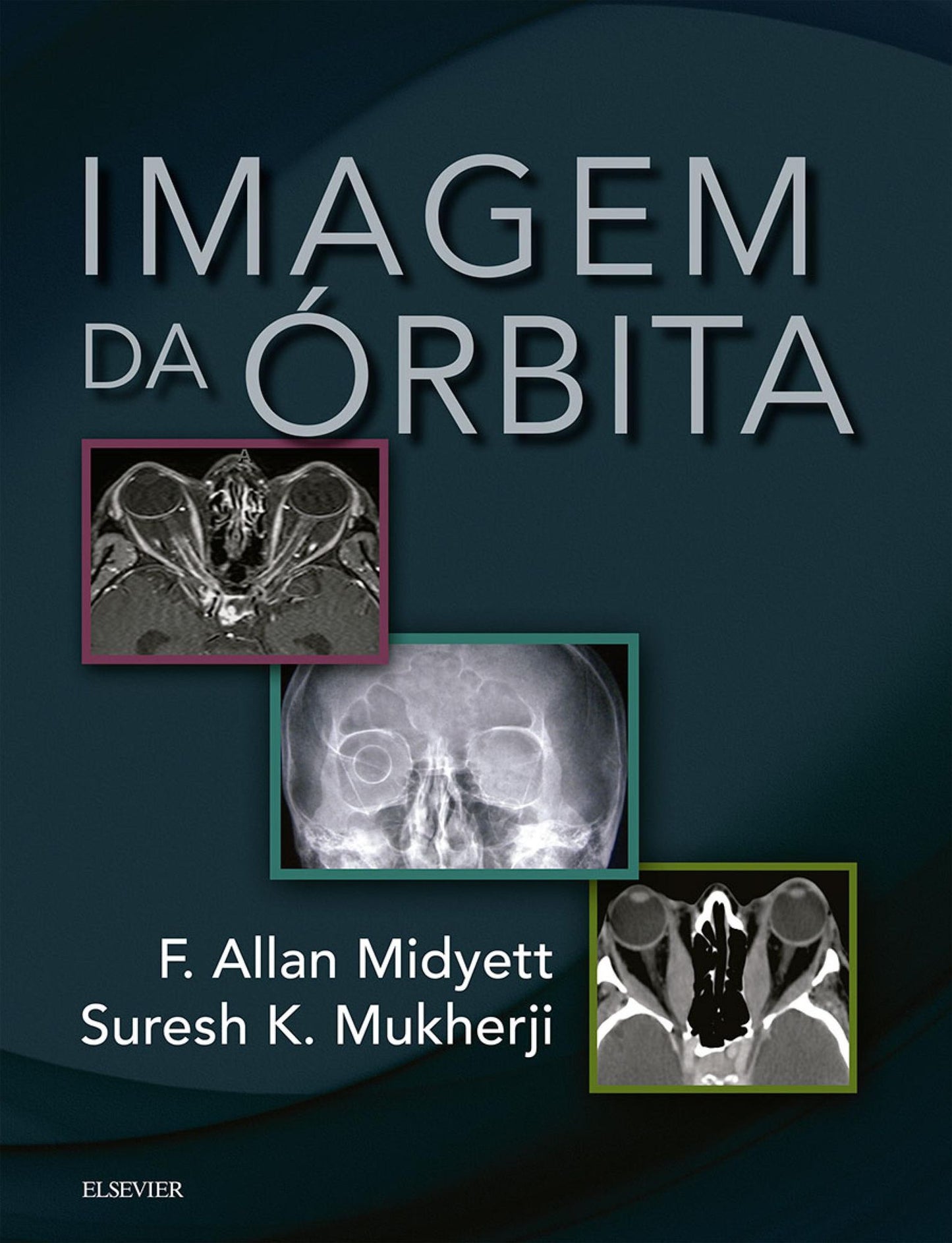 Imagem da Órbita