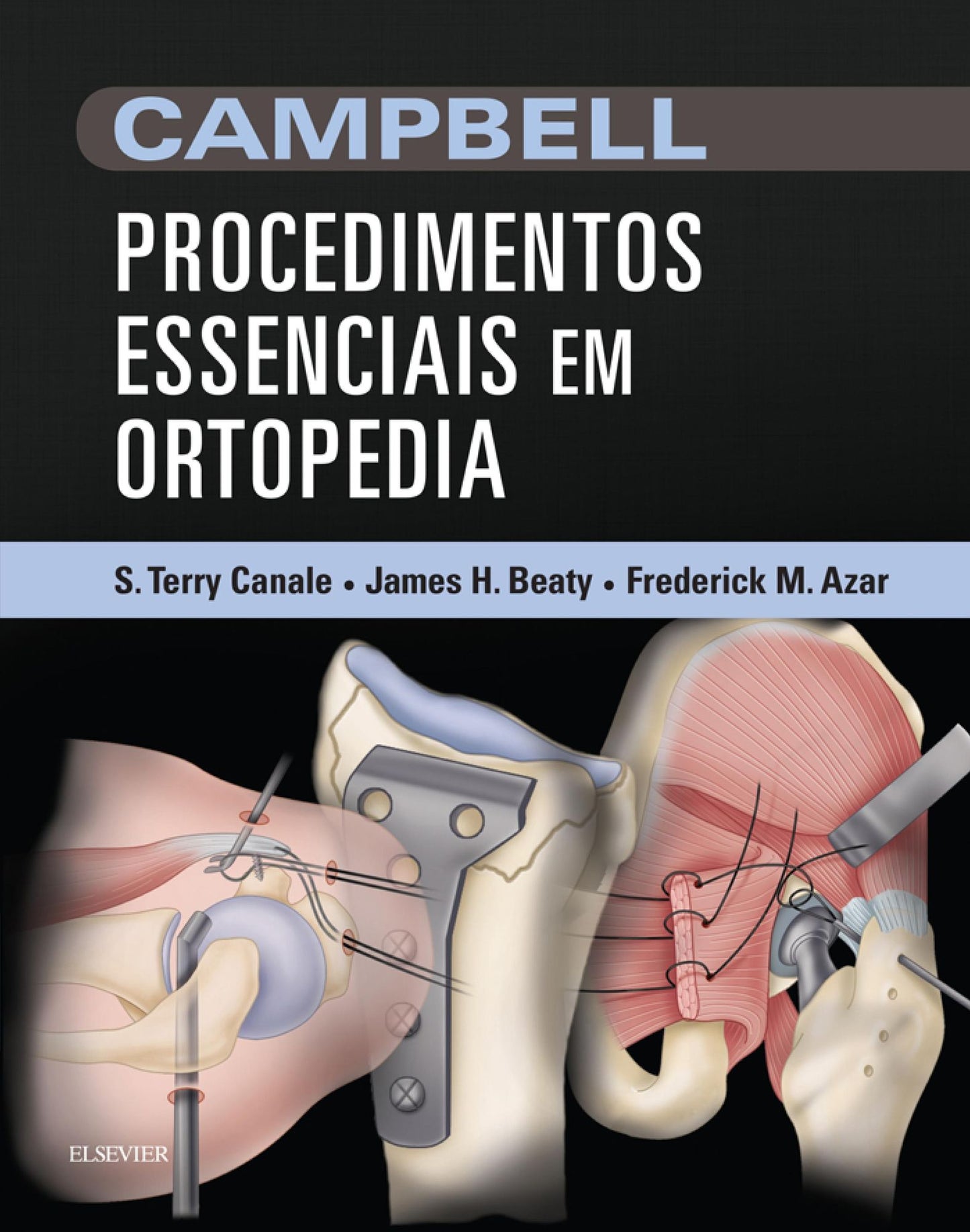 CAMPBELL Procedimentos Essenciais em Ortopedia