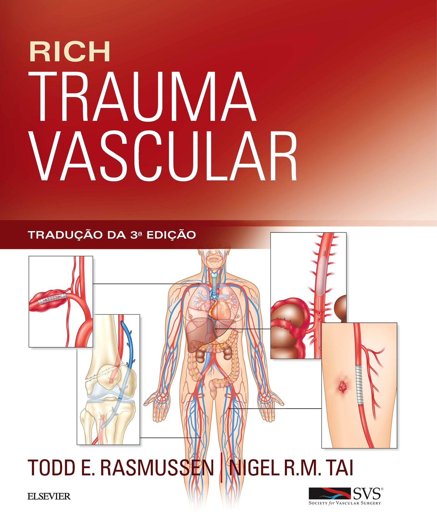 Rich Trauma Vascular