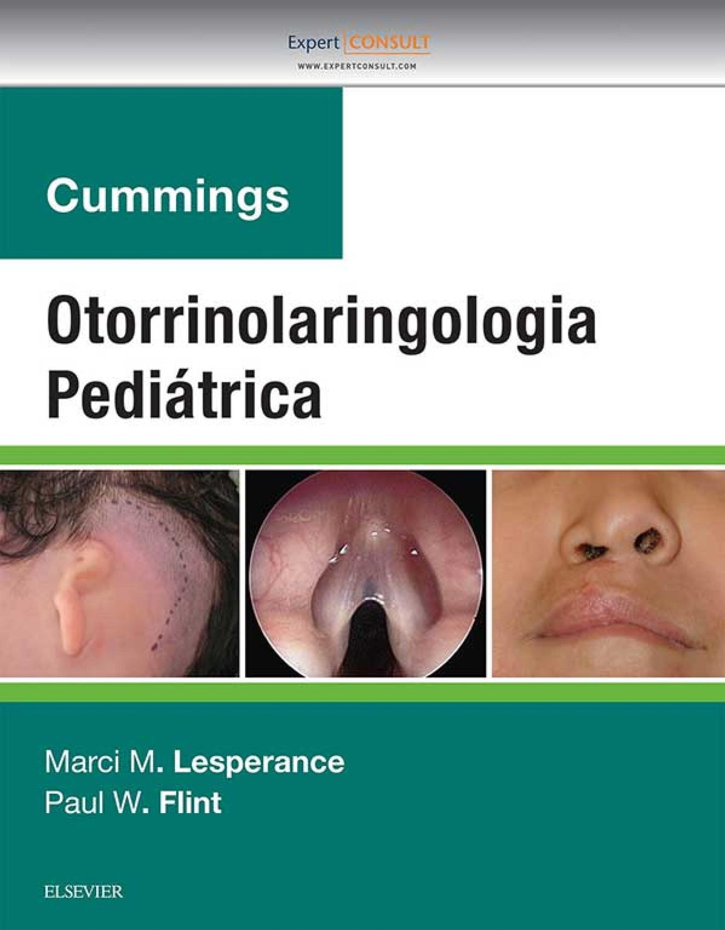 Cummings Otorrinolaringologia Pediátrica