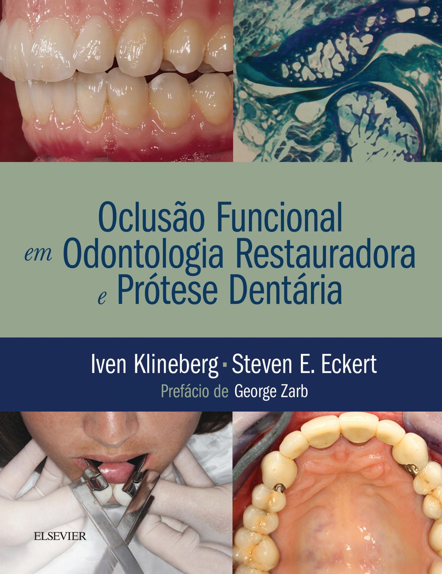 Oclusão Funcional em Odontologia Restauradora e Prótese