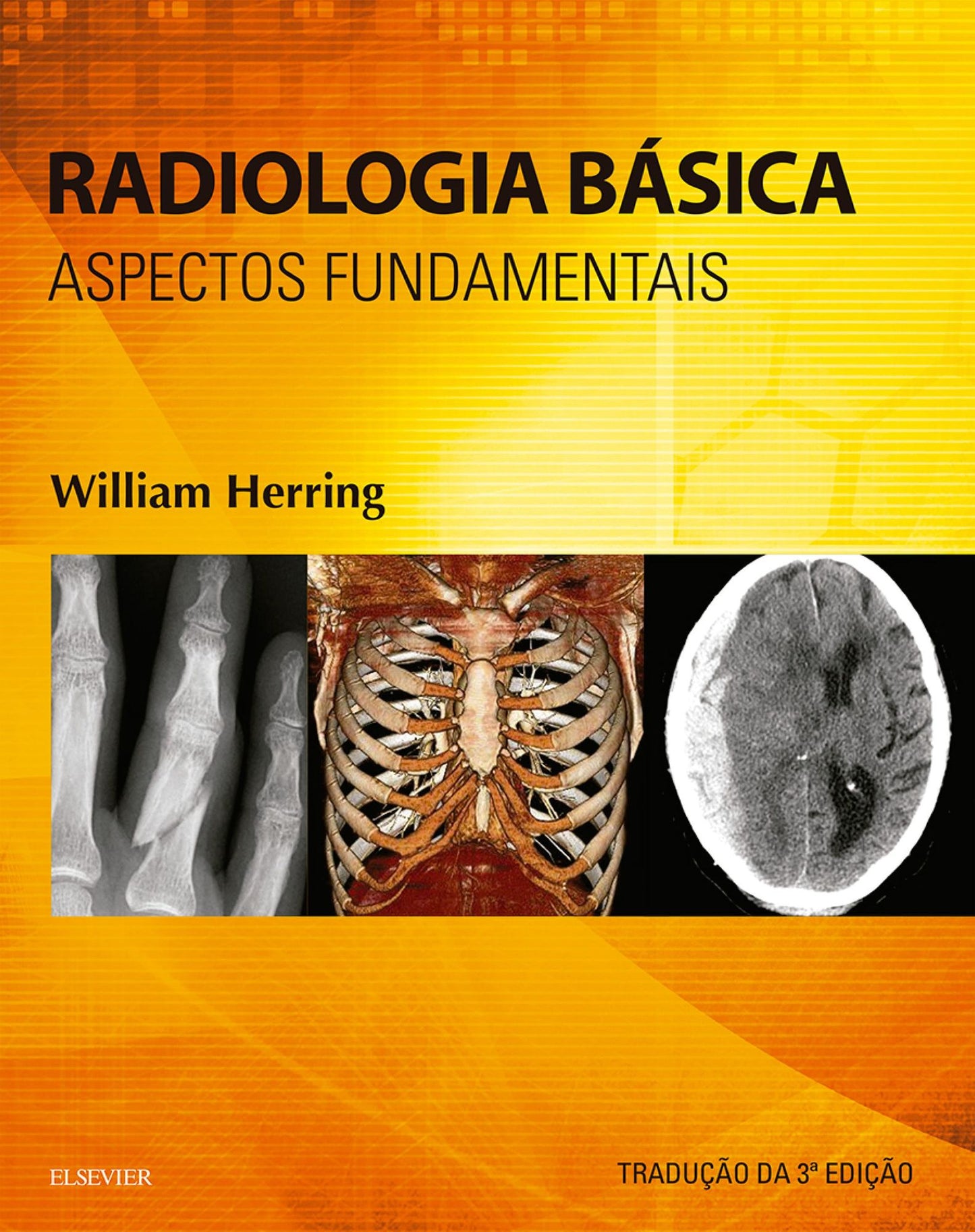 Radiologia Básica: Aspectos Fundamentais