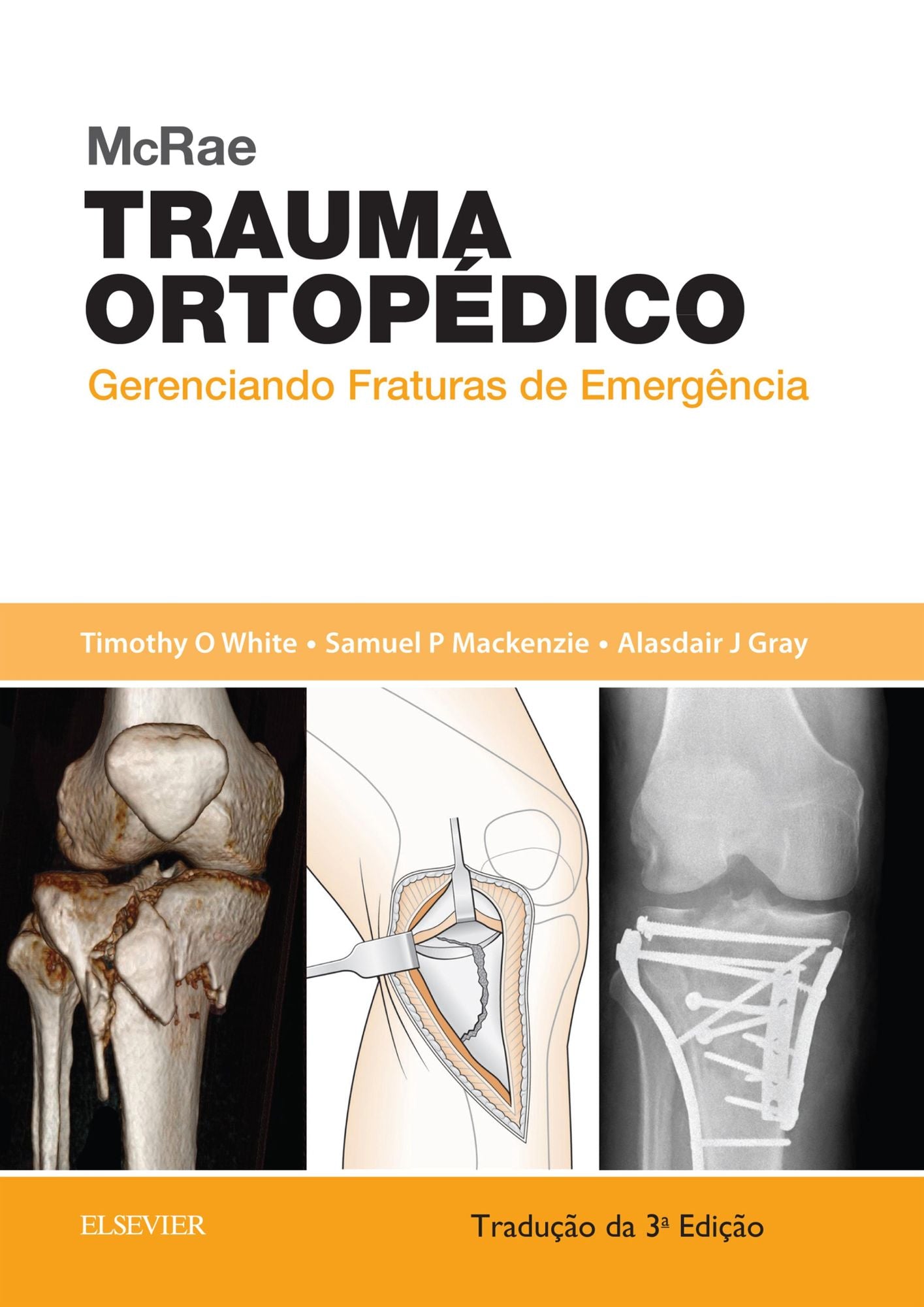 McRae Trauma Ortopédico: Gerenciando Fraturas de Emergência
