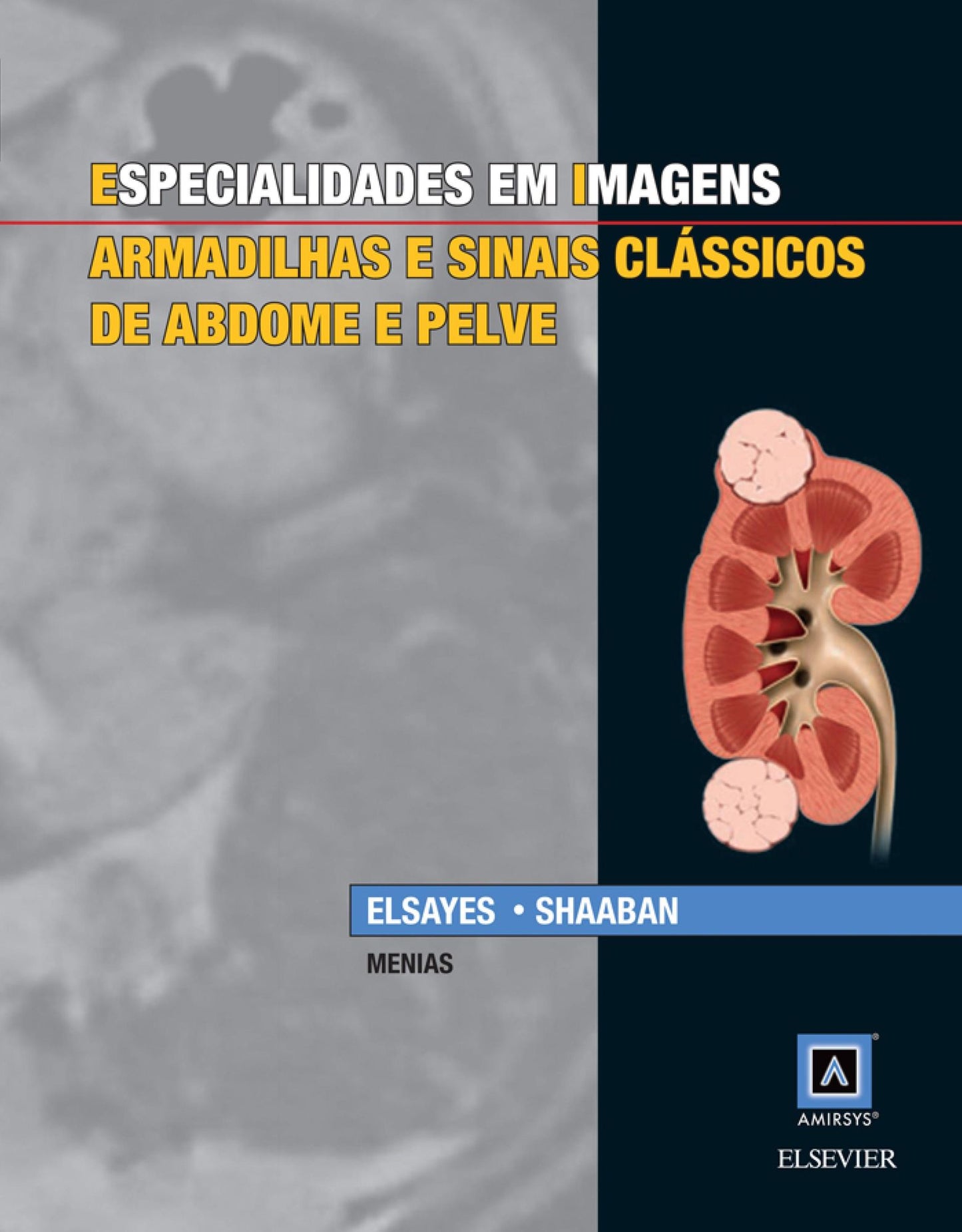 Especialidades em Imagens: Armadilhas e Sinais Clássicos de Abdome e Pelve