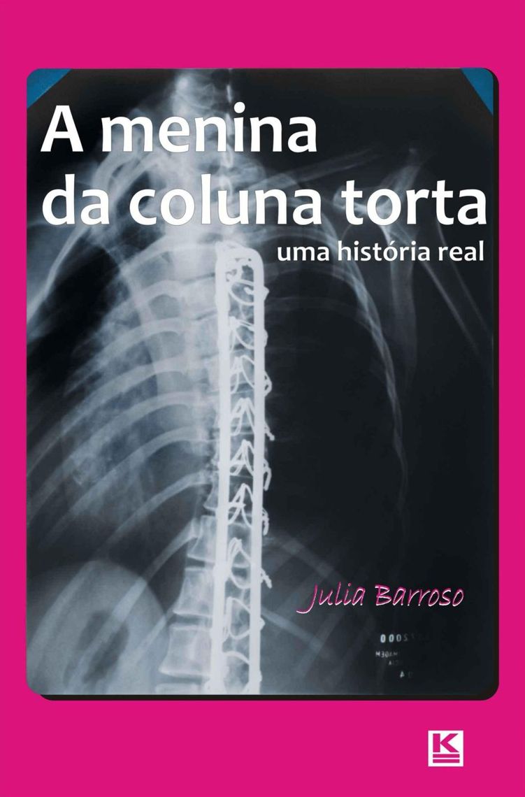 A menina da coluna torta