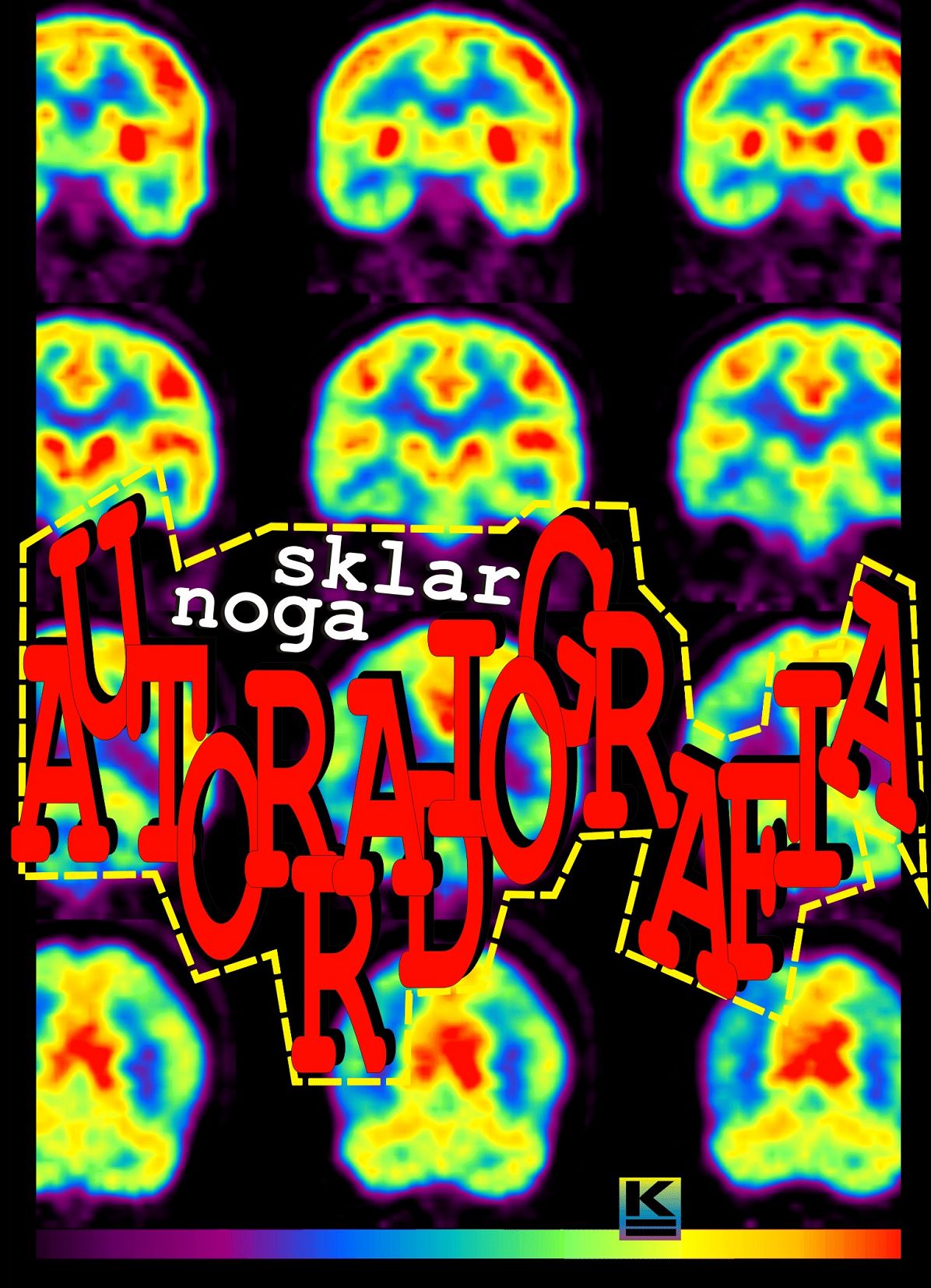 Autorradiografia