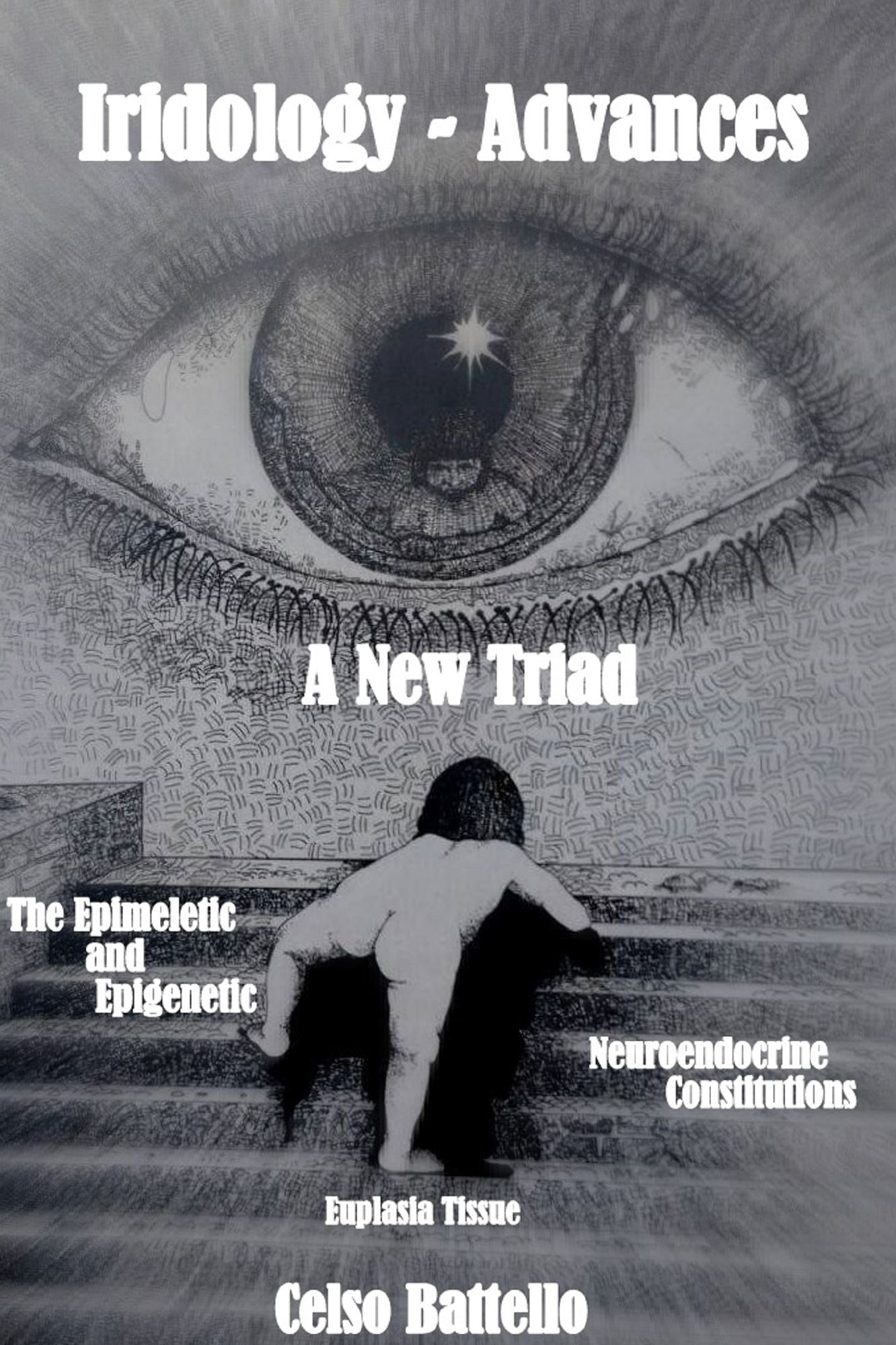 Iridology - Advances : A New triad