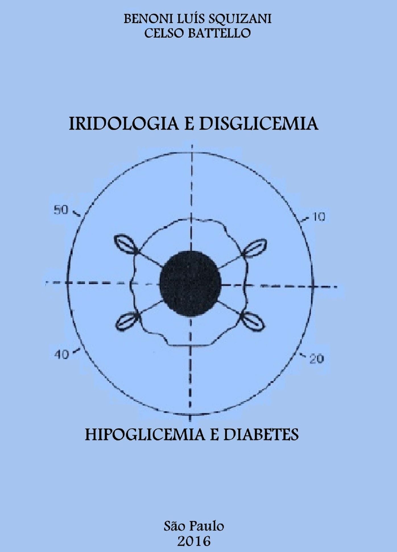 Iridologia e Disglicemia: Hipoglicemia e Diabetes
