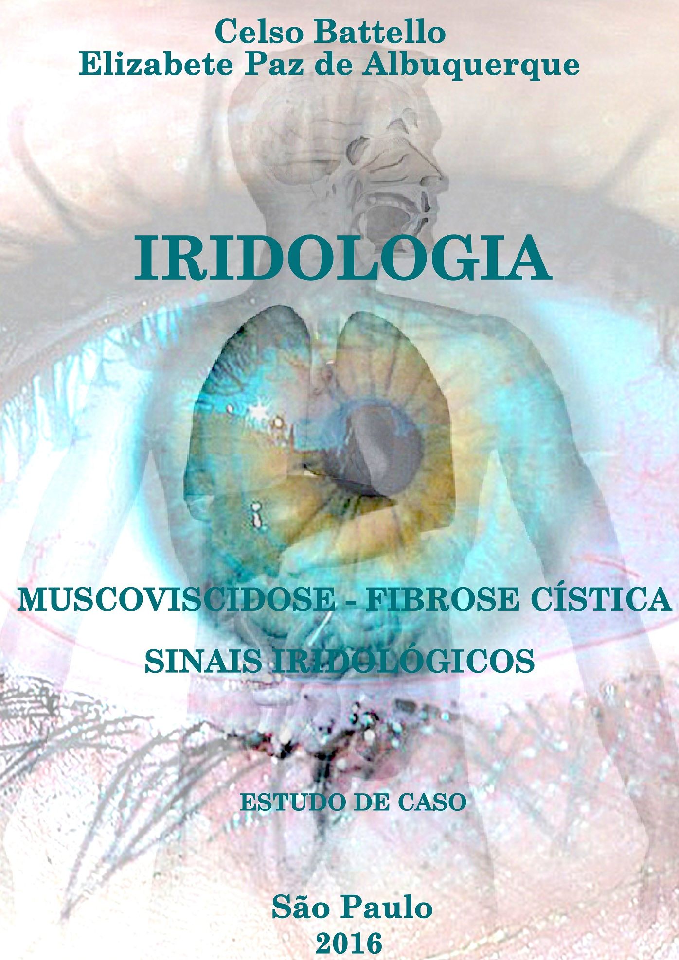 Iridologia e Fibrose Cística: Mucoviscidose e Sinais Iridológicos