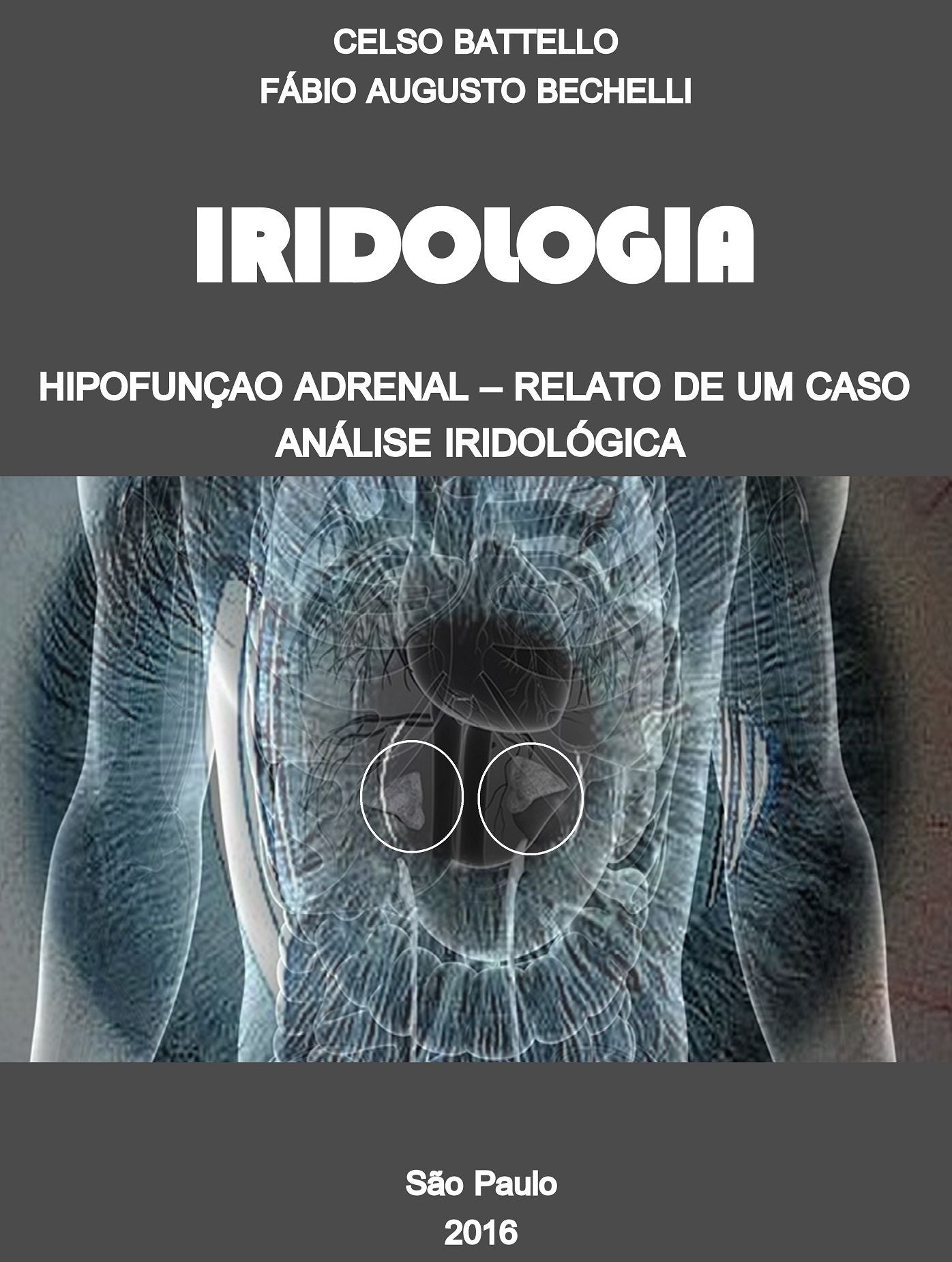 Iridologia - Hipofunção Adrenal: Relato de um Caso - Análise Iridológica