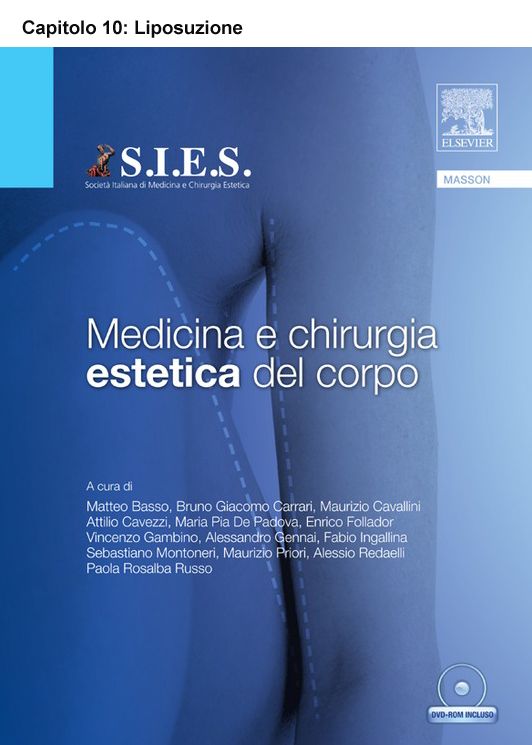 Liposuzione