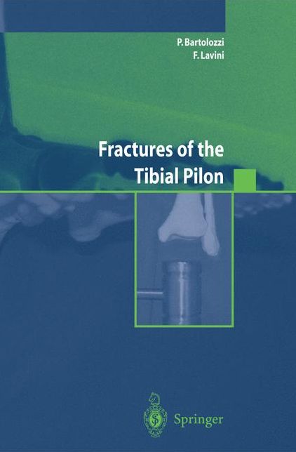 Fractures of the Tibial Pilon