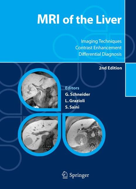 MRI of the Liver: Imaging Techniques, Contrast Enhancement, Differential Diagnosis