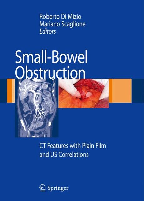 Small-Bowel Obstruction: CT Features with Plain Film and US correlations