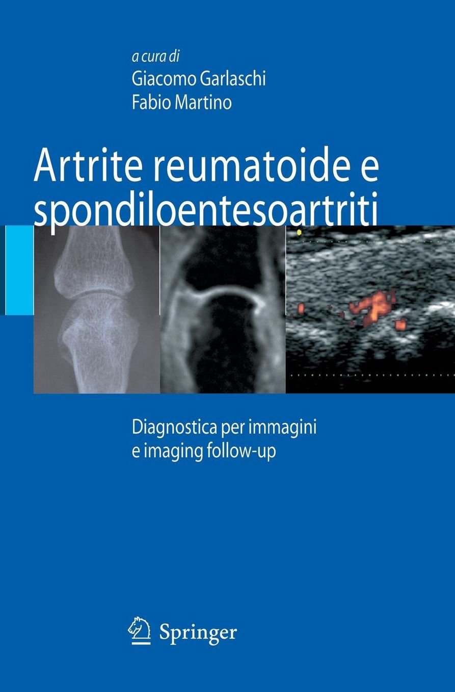 Artrite reumatoide e spondiloentesoartriti: Diagnostica per immagini ed imaging follow-up