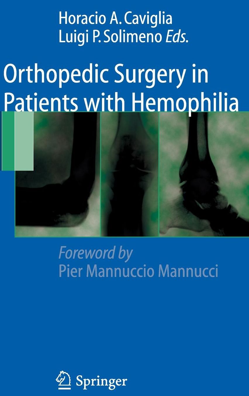 Orthopedic Surgery in Patients with Hemophilia