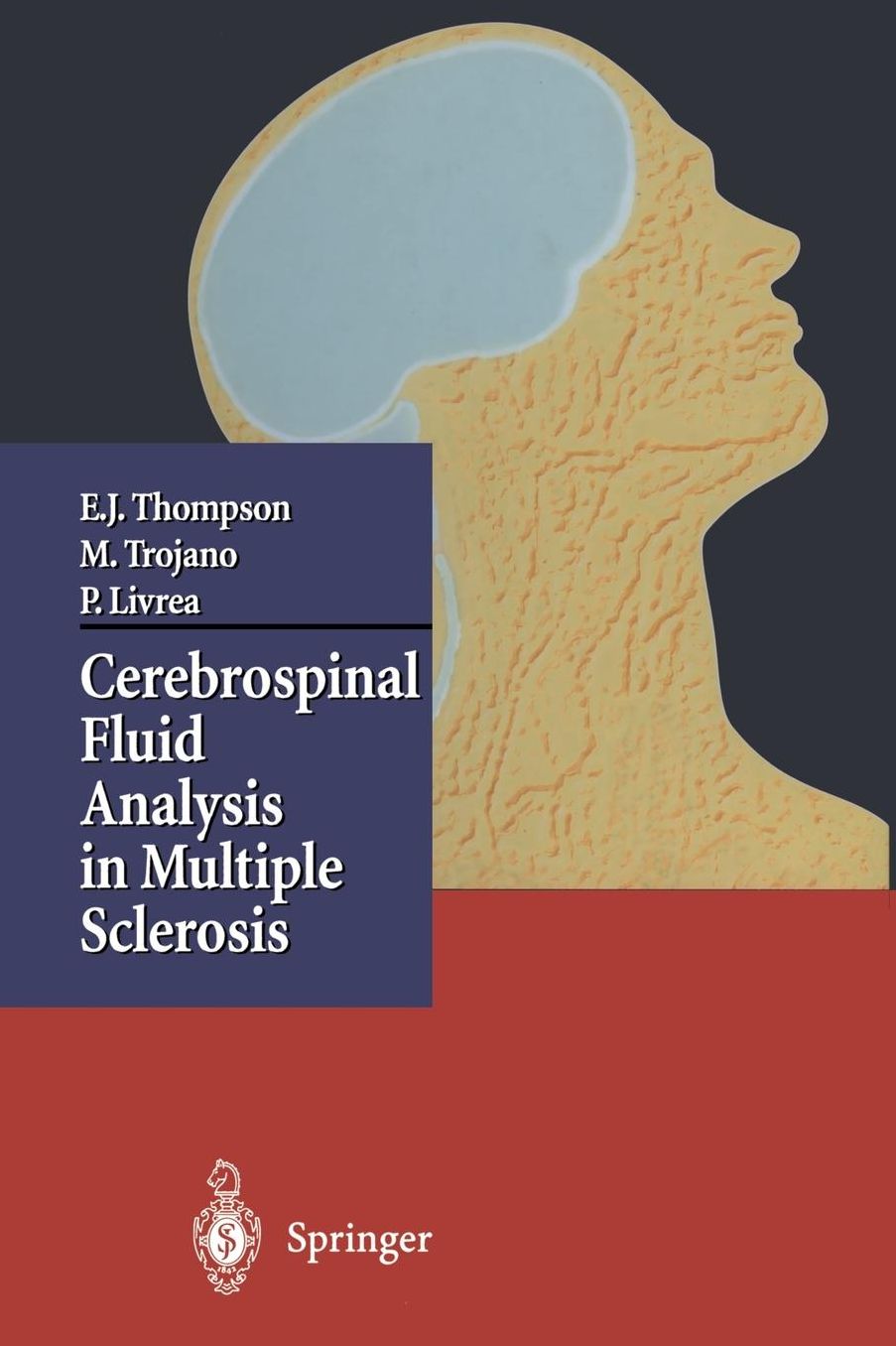 Cerebrospinal Fluid Analysis in Multiple Sclerosis