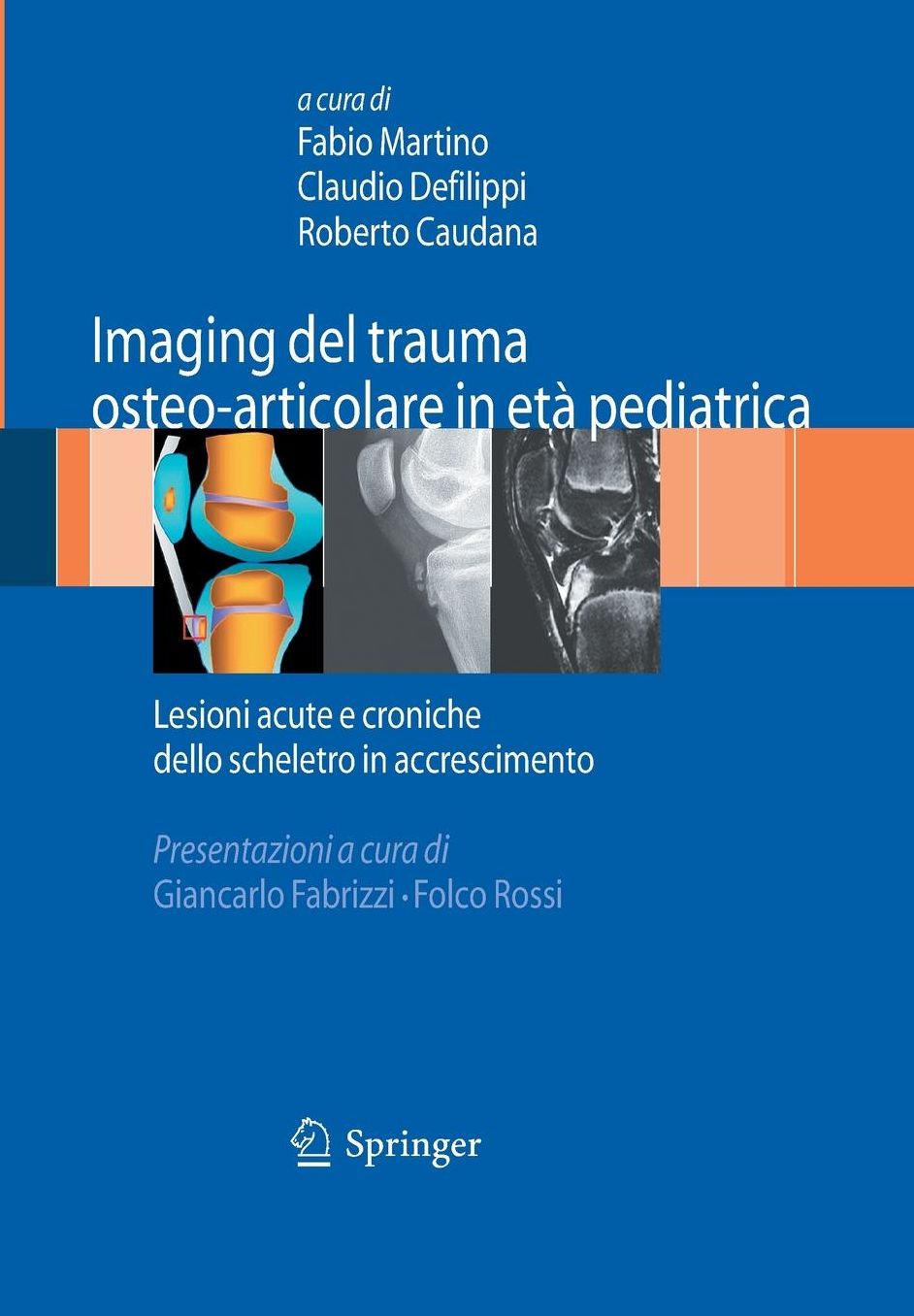 Imaging del trauma osteo-articolare in età pediatrica: Lesioni acute e croniche dello scheletro in accrescimento